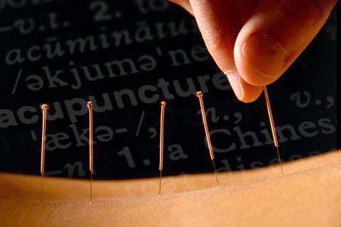 acupuncture program