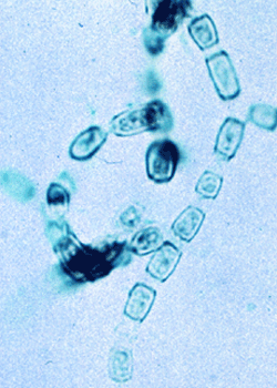 cocci valley fever spores